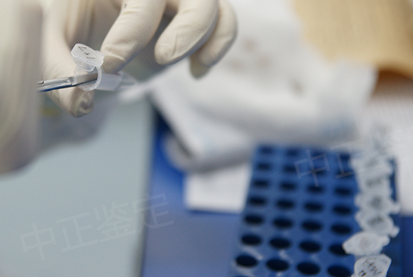 南昌医院办理DNA鉴定准不准确,医院办理DNA鉴定生物样本有些什么